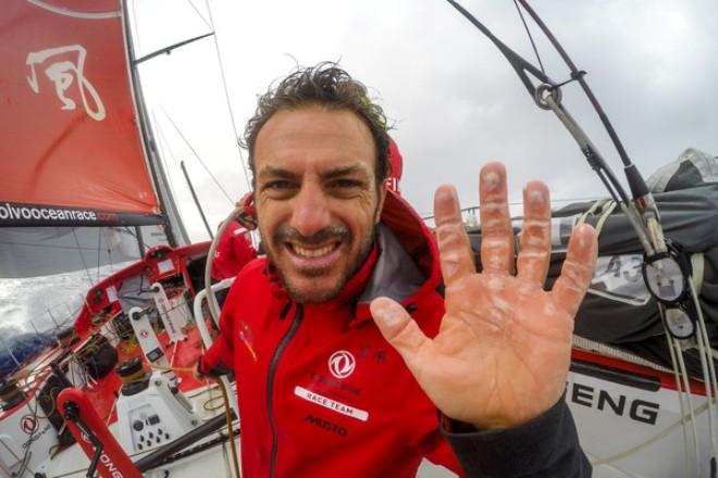 Dongfeng Race Team - Eric Peron and his bathtub hands - Volvo Ocean Race 2014-15 © Sam Greenfield/Dongfeng Race Team/Volvo Ocean Race